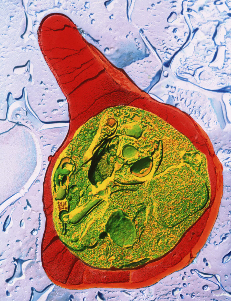 A colored microscope image of the malaria parasite, Plasmodium sp. (green), infecting a red blood cell (red). Malaria is spread from infected Anopheles mosquitoes to people. The parasites infect the liver, then move into the blood.