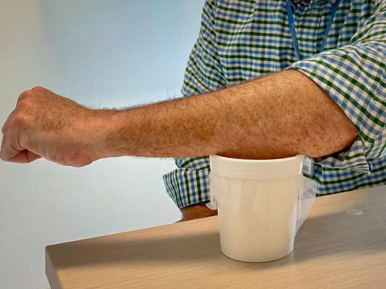 Sean Murphy, lead author of a new malaria vaccine study, demonstrates how participants got their dose: by placing an arm over a mesh-covered container filled with 200 mosquitoes whose bites delivered genetically modified malaria parasites.